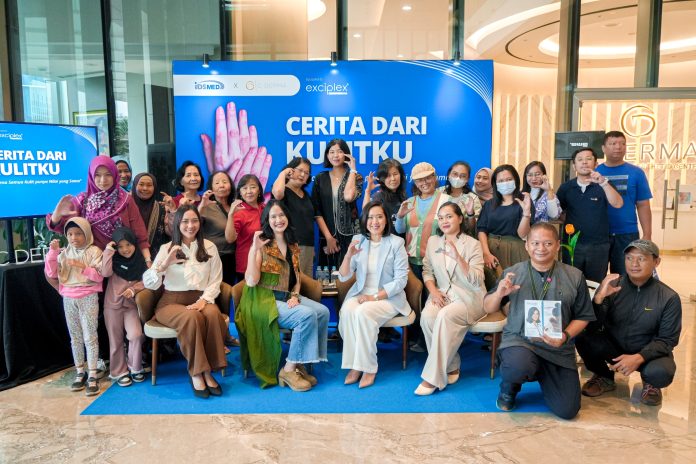 C Derma Gandeng Komunitas Vitiligo Indonesia Kenalkan Exciplex Clarteis, Perkuat Pemahaman Medis & Psikologis Vitiligo