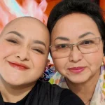 Lizzie Parra Cukur Habis Rambut saat Lawan Kanker