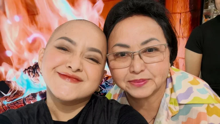 Lizzie Parra Cukur Habis Rambut saat Lawan Kanker